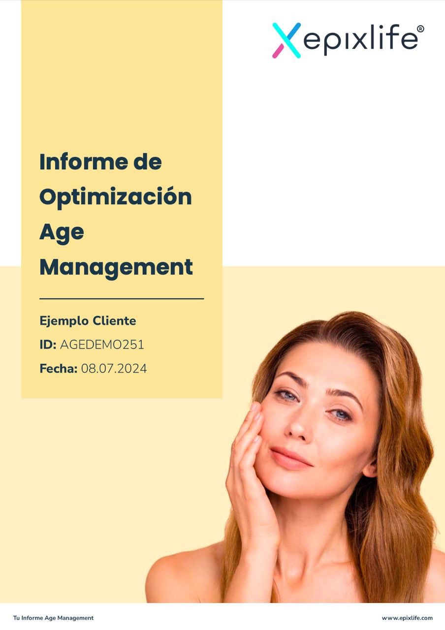 Informe Age Management